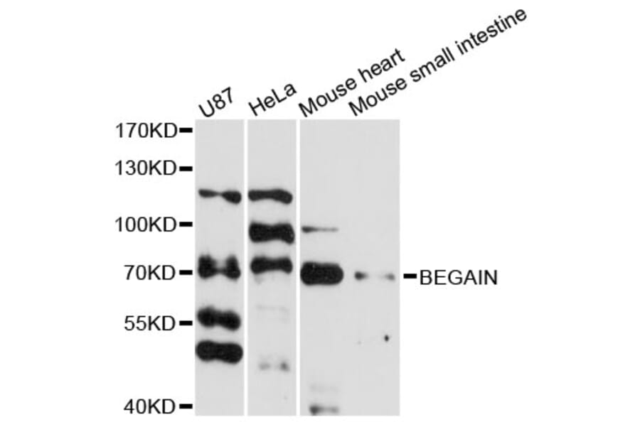 Western Blot - Anti-BEGAIN Antibody (A13894) - Antibodies.com
