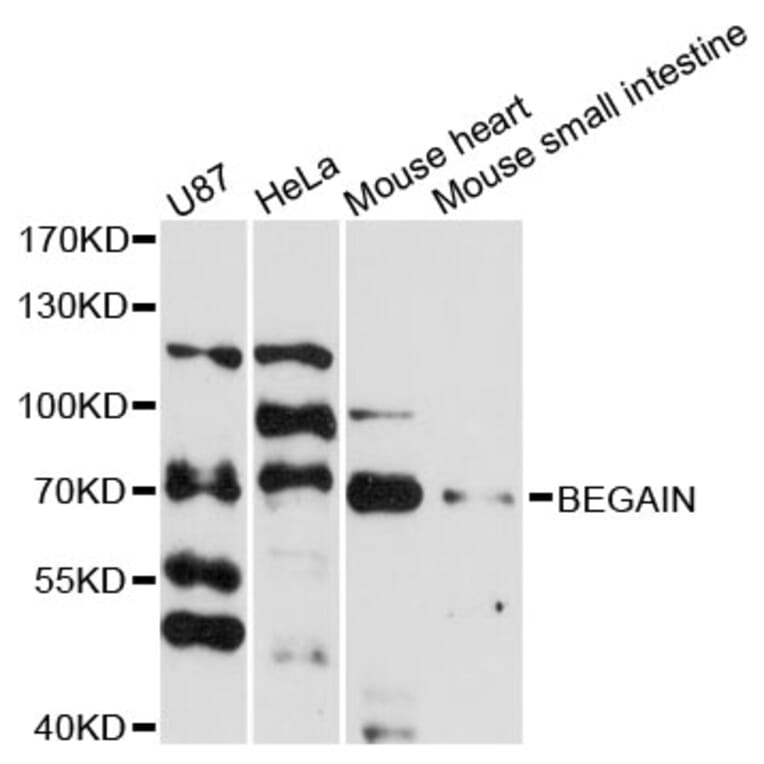 Western Blot - Anti-BEGAIN Antibody (A13894) - Antibodies.com