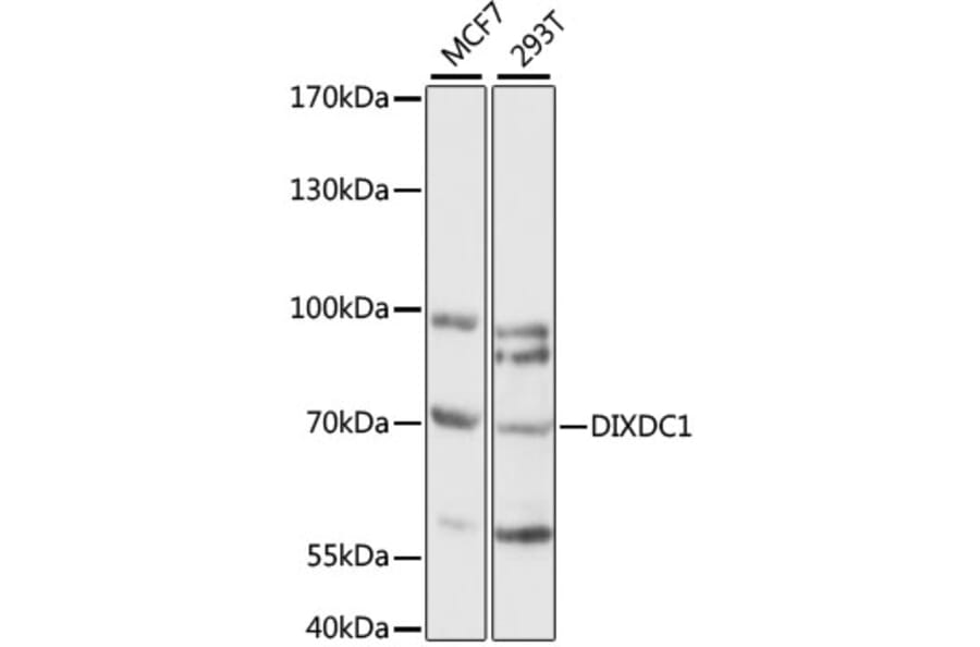 Western Blot - Anti-DIXDC1 Antibody (A90968) - Antibodies.com