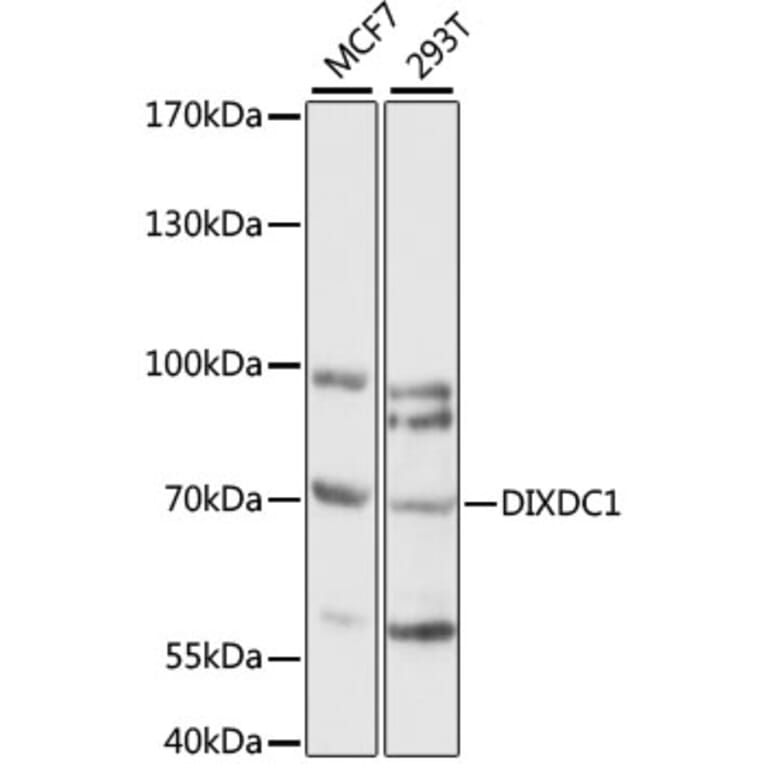 Western Blot - Anti-DIXDC1 Antibody (A90968) - Antibodies.com
