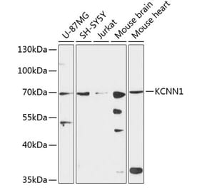 Western Blot - Anti-KCNN1 Antibody (A90969) - Antibodies.com