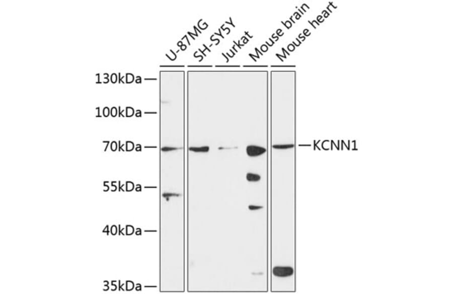 Western Blot - Anti-KCNN1 Antibody (A90969) - Antibodies.com