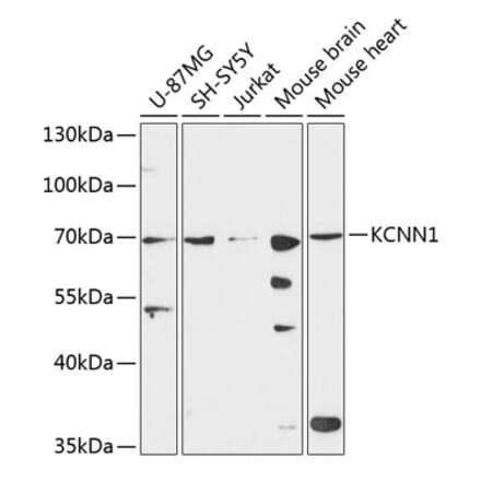 Western Blot - Anti-KCNN1 Antibody (A90969) - Antibodies.com