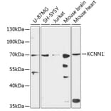 Western Blot - Anti-KCNN1 Antibody (A90969) - Antibodies.com