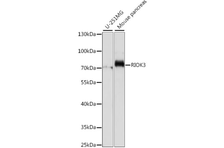 Western Blot - Anti-RIOK3 Antibody (A90970) - Antibodies.com