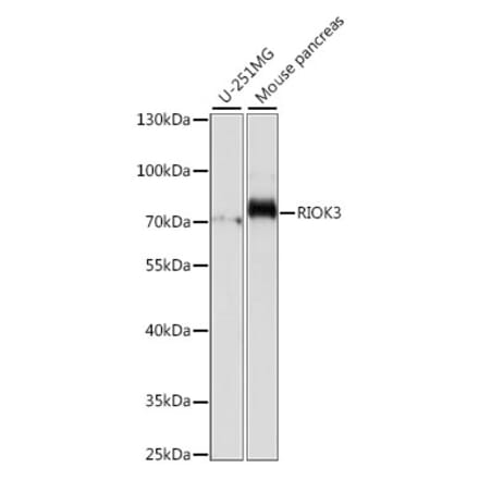 Western Blot - Anti-RIOK3 Antibody (A90970) - Antibodies.com