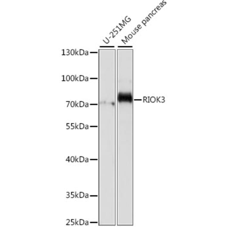 Western Blot - Anti-RIOK3 Antibody (A90970) - Antibodies.com