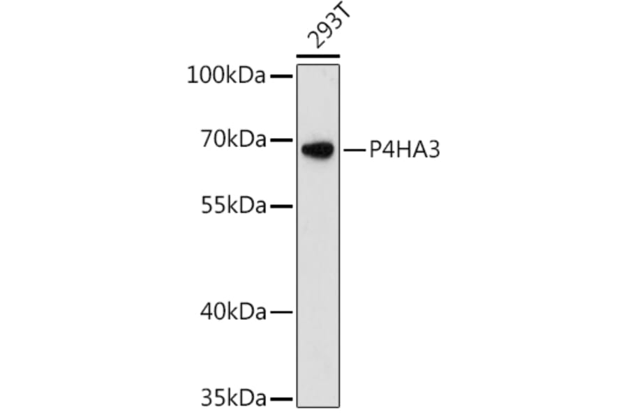 Western Blot - Anti-P4HA3 Antibody (A90971) - Antibodies.com
