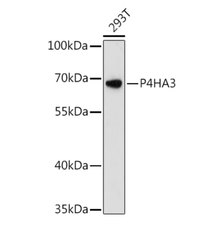 Western Blot - Anti-P4HA3 Antibody (A90971) - Antibodies.com