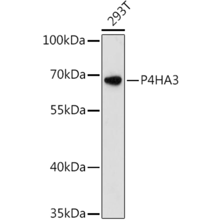 Western Blot - Anti-P4HA3 Antibody (A90971) - Antibodies.com