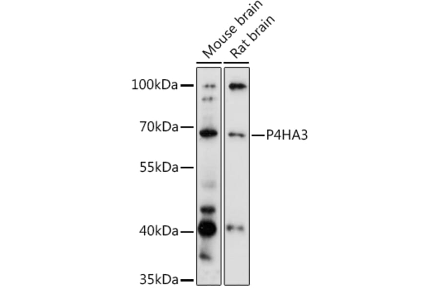 Western Blot - Anti-P4HA3 Antibody (A90971) - Antibodies.com