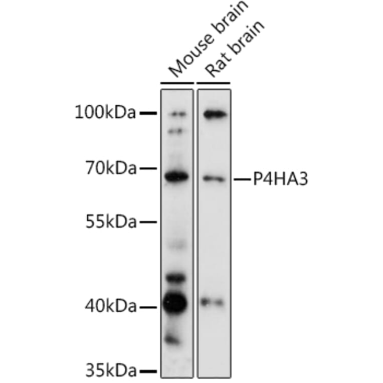 Western Blot - Anti-P4HA3 Antibody (A90971) - Antibodies.com