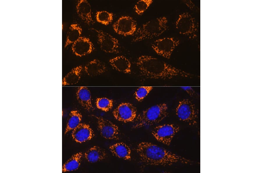 Immunofluorescence - Anti-P4HA3 Antibody (A90971) - Antibodies.com