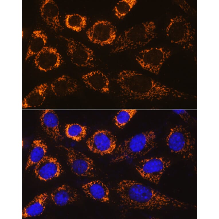 Immunofluorescence - Anti-P4HA3 Antibody (A90971) - Antibodies.com