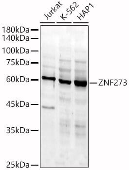 Western blot analysis of extracts of SH-SY5Y cells, using Anti-ZNF273 Antibody (A14847) at 1:1,000 dilution.
Secondary antibody: Goat Anti-Rabbit IgG (H+L) (HRP) (AS014) at 1:10,000 dilution.
Lysates / proteins: 25µg per lane.
Blocking buffer: 3% non-fat dry milk in TBST.
Detection: ECL Basic Kit (RM00020).
Exposure time: 15s.
