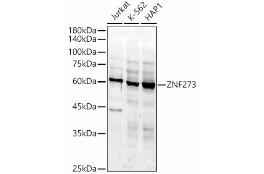 Western Blot - Anti-ZNF273 Antibody (A90972) - Antibodies.com