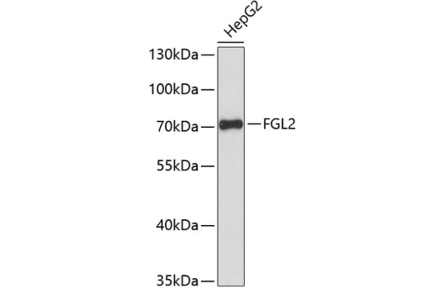 Western Blot - Anti-FGL2/Prothrombinase Antibody (A90973) - Antibodies.com