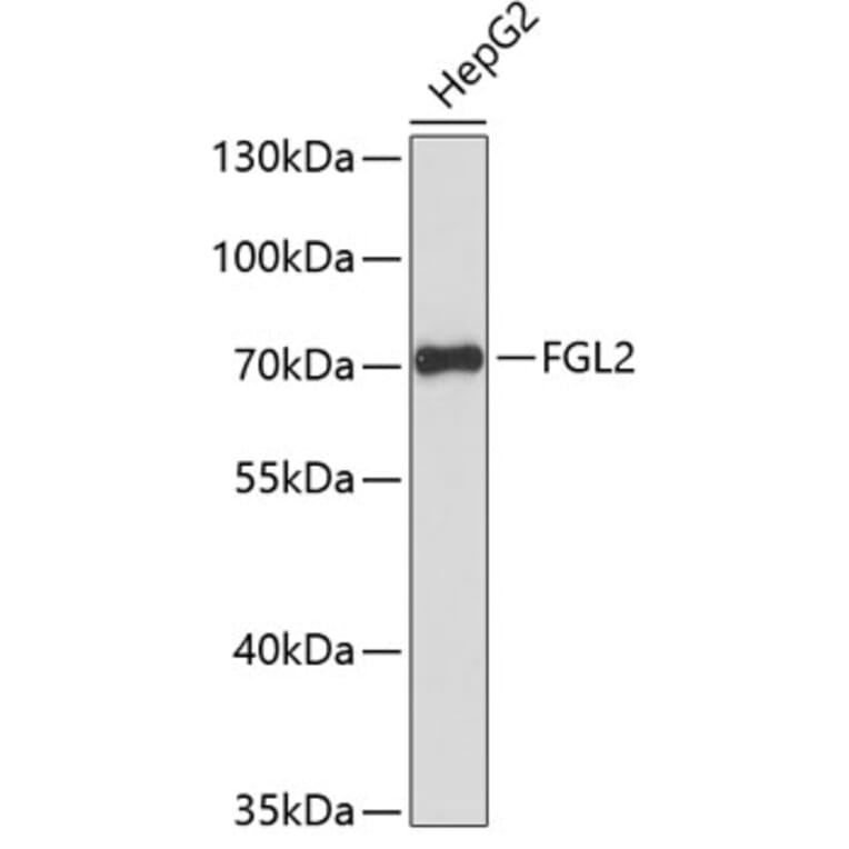 Western Blot - Anti-FGL2/Prothrombinase Antibody (A90973) - Antibodies.com