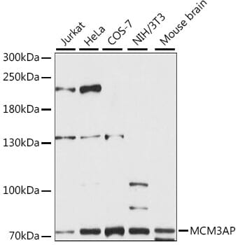 Western blot analysis of extracts of various cell lines, using Anti-MCM3AP Antibody (A15747) at 1:1,000 dilution.
Secondary antibody: Goat Anti-Rabbit IgG (H+L) (HRP) (AS014) at 1:10,000 dilution.
Lysates / proteins: 25µg per lane.
Blocking buffer: 3% non-fat dry milk in TBST.
Detection: ECL Enhanced Kit (RM00021).
Exposure time: 60s.