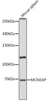 Western blot analysis of extracts of mouse spleen, using Anti-MCM3AP Antibody (A15748) at 1:1,000 dilution.
Secondary antibody: Goat Anti-Rabbit IgG (H+L) (HRP) (AS014) at 1:10,000 dilution.
Lysates / proteins: 25µg per lane.
Blocking buffer: 3% non-fat dry milk in TBST.
Detection: ECL Enhanced Kit (RM00021).
Exposure time: 60s.