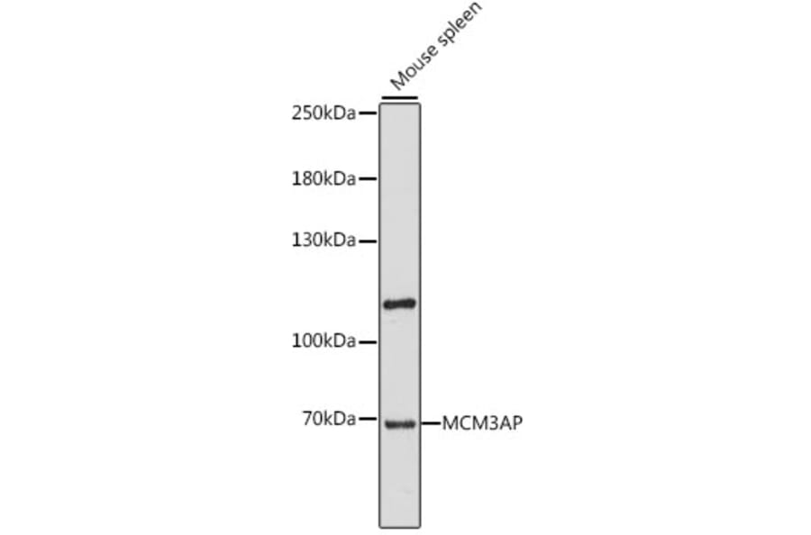 Western Blot - Anti-GANP Antibody (A90975) - Antibodies.com