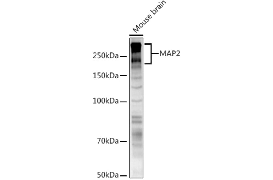 Western Blot - Anti-MAP2 Antibody (A90976) - Antibodies.com
