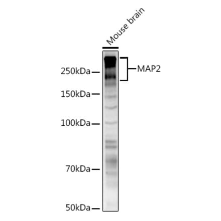Western Blot - Anti-MAP2 Antibody (A90976) - Antibodies.com