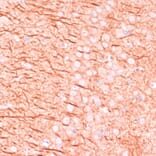 Immunohistochemistry - Anti-MAP2 Antibody (A90976) - Antibodies.com