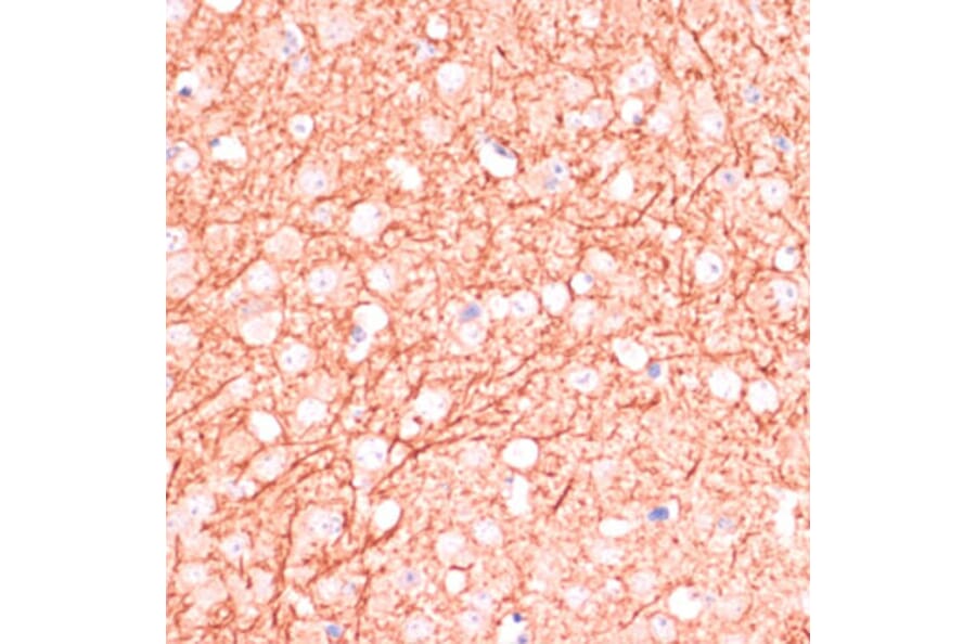 Immunohistochemistry - Anti-MAP2 Antibody (A90976) - Antibodies.com
