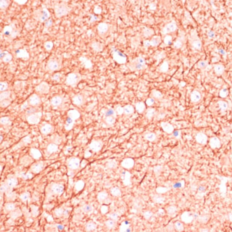 Immunohistochemistry - Anti-MAP2 Antibody (A90976) - Antibodies.com