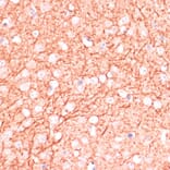 Immunohistochemistry - Anti-MAP2 Antibody (A90976) - Antibodies.com