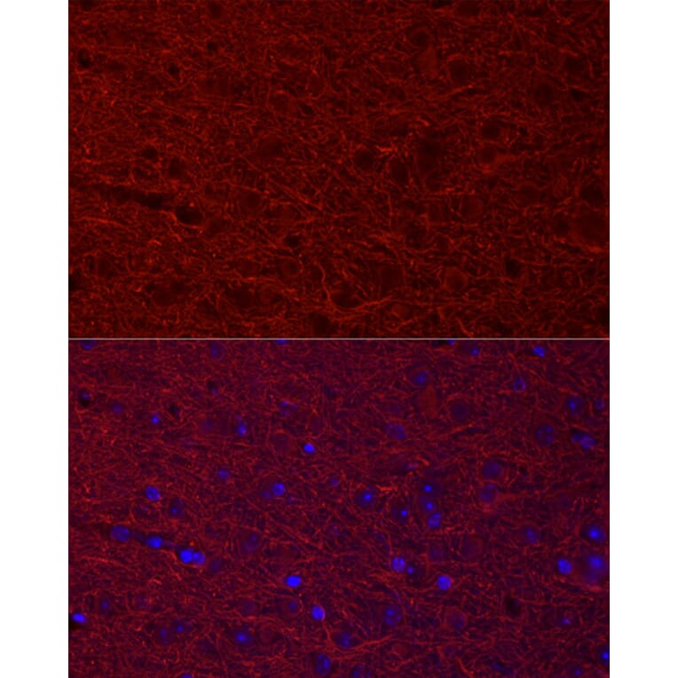 Immunofluorescence - Anti-MAP2 Antibody (A90976) - Antibodies.com