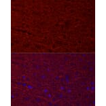 Immunofluorescence - Anti-MAP2 Antibody (A90976) - Antibodies.com