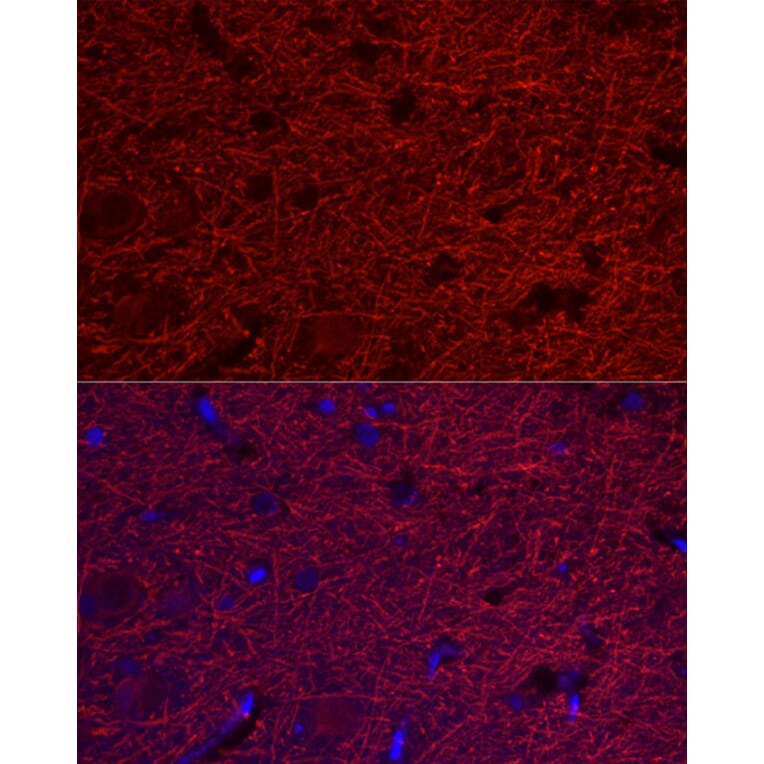 Immunofluorescence - Anti-MAP2 Antibody (A90976) - Antibodies.com