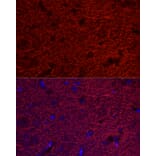 Immunofluorescence - Anti-MAP2 Antibody (A90976) - Antibodies.com