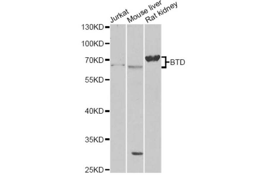 Western Blot - Anti-BTD Antibody (A13955) - Antibodies.com