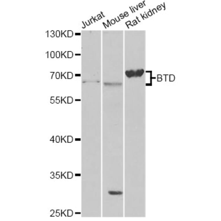 Western Blot - Anti-BTD Antibody (A13955) - Antibodies.com
