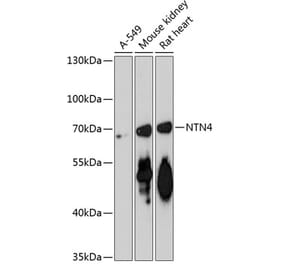 Western Blot - Anti-Netrin 4 Antibody (A90978) - Antibodies.com