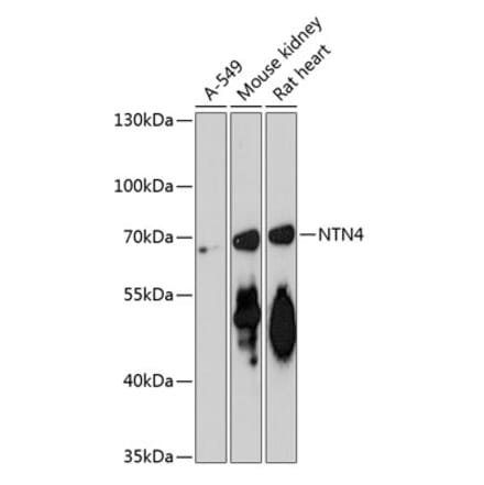 Western Blot - Anti-Netrin 4 Antibody (A90978) - Antibodies.com