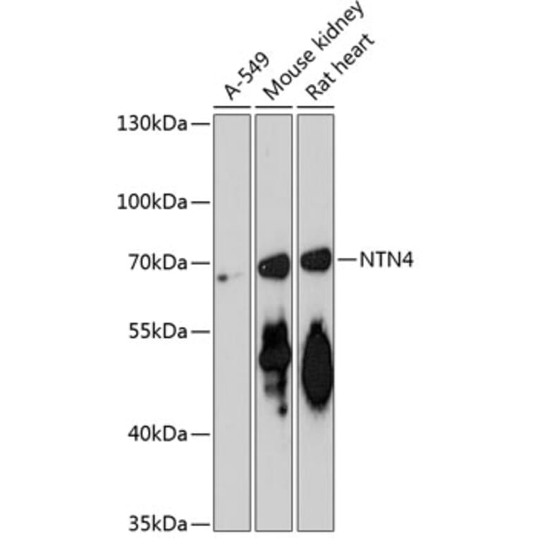 Western Blot - Anti-Netrin 4 Antibody (A90978) - Antibodies.com