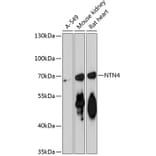 Western Blot - Anti-Netrin 4 Antibody (A90978) - Antibodies.com