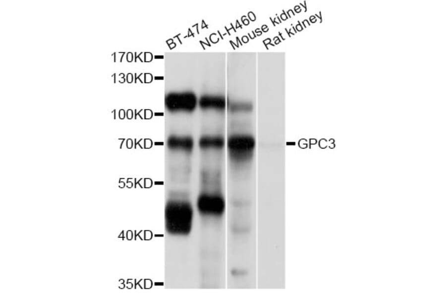 Western Blot - Anti-GPC3 Antibody (A12384) - Antibodies.com