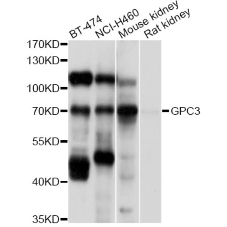 Western Blot - Anti-GPC3 Antibody (A12384) - Antibodies.com