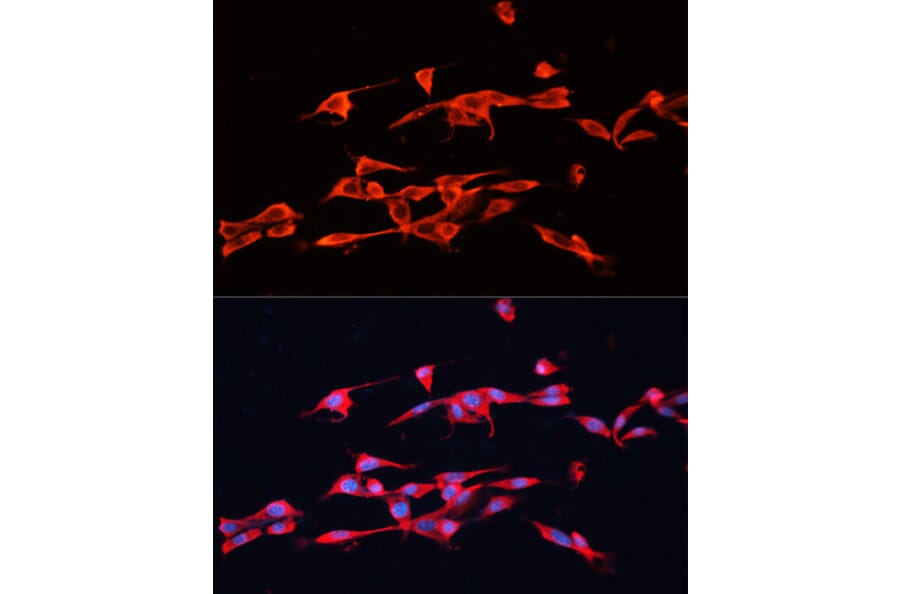 Immunofluorescence - Anti-GPC3 Antibody (A12384) - Antibodies.com