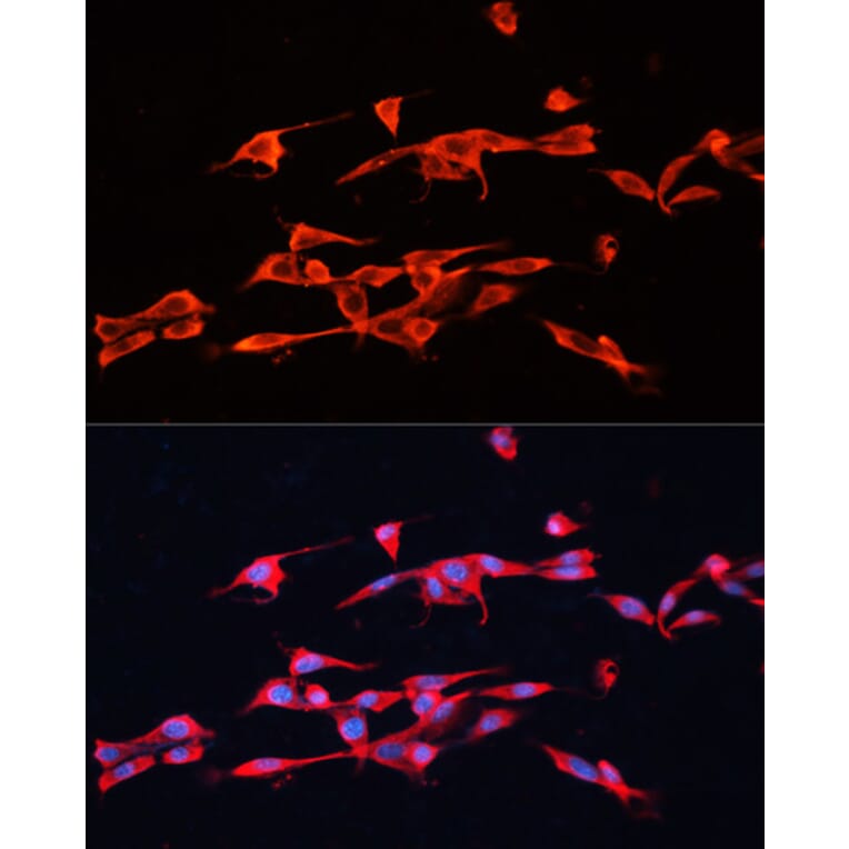 Immunofluorescence - Anti-GPC3 Antibody (A12384) - Antibodies.com