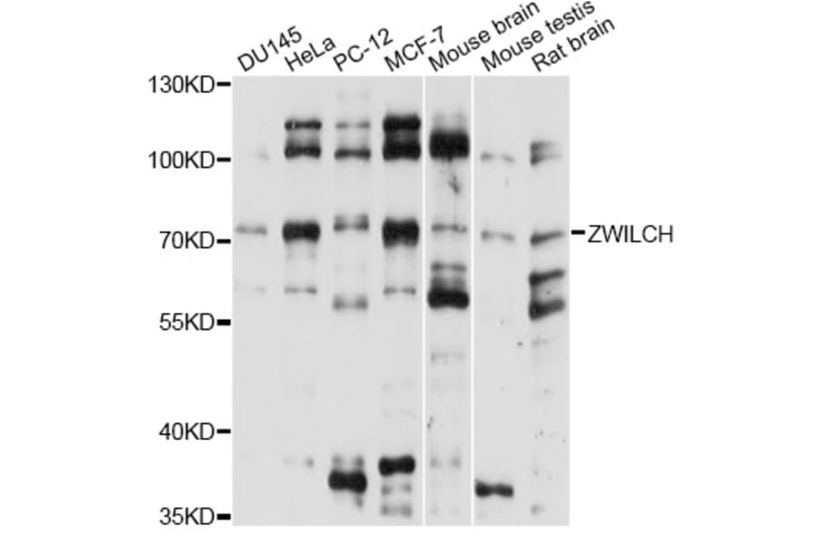 Western Blot - Anti-ZWILCH Antibody (A14627) - Antibodies.com