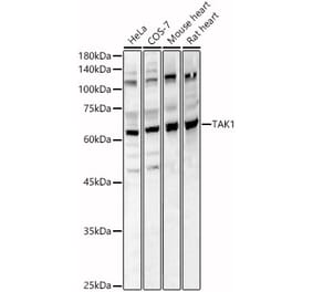 Western Blot - Anti-TAK1 Antibody (A90981) - Antibodies.com