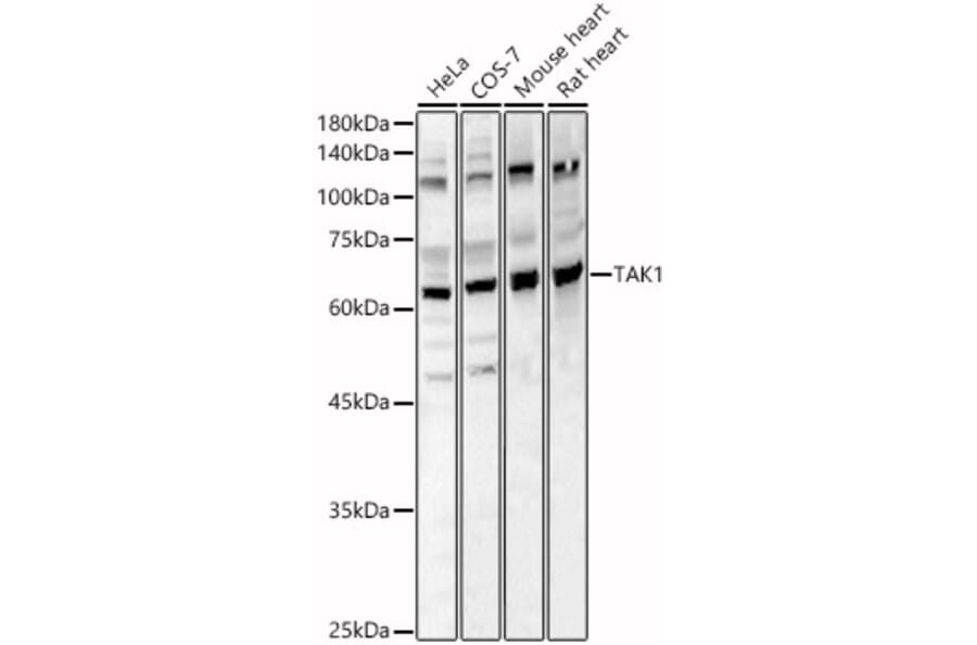 Western Blot - Anti-TAK1 Antibody (A90981) - Antibodies.com