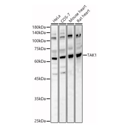 Western Blot - Anti-TAK1 Antibody (A90981) - Antibodies.com