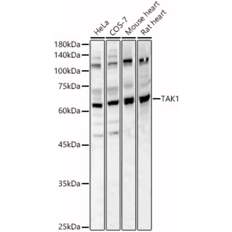 Western Blot - Anti-TAK1 Antibody (A90981) - Antibodies.com